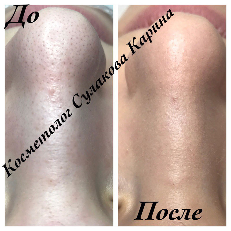 �����-������ ������ � ������ ���������� �������