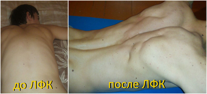 �������� ����� ����������� (���������)