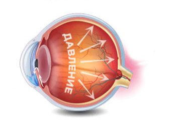 "TopMedical" - "����������" (����������� �����)